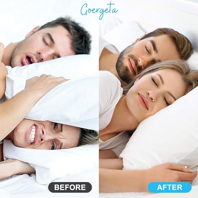 Nasal Strip (BUY1GET1FREE)